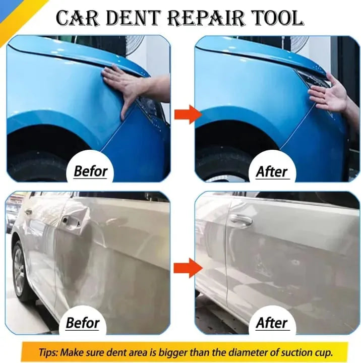 Heavy-Duty Car Dent Remover & Suction Cup Dent Puller
